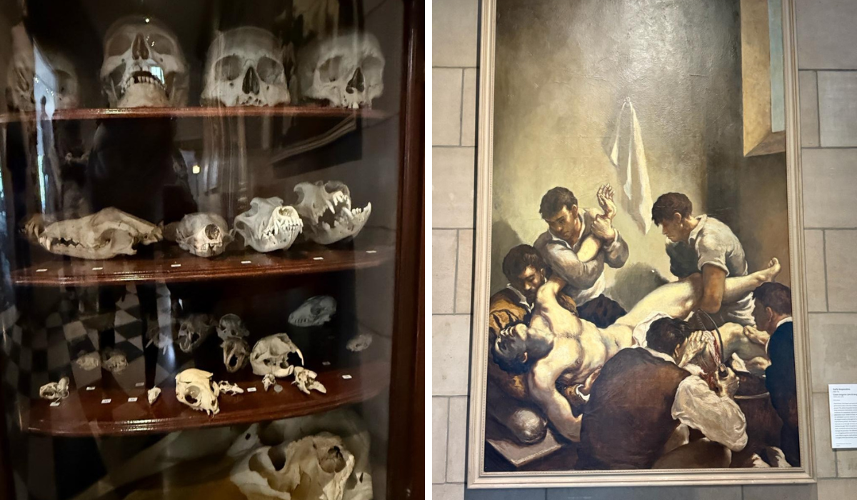 photos from the museum of surgical science in chicago; a photo of skulls on the left and a painting of an old surgery on the right